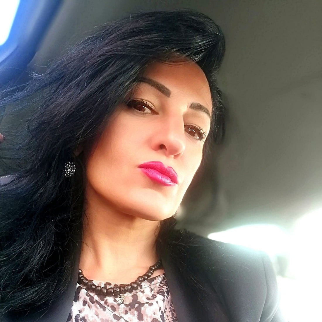 La mia storia: Epilessia per 20 anni e la svolta con la Paleo-Chetogenica